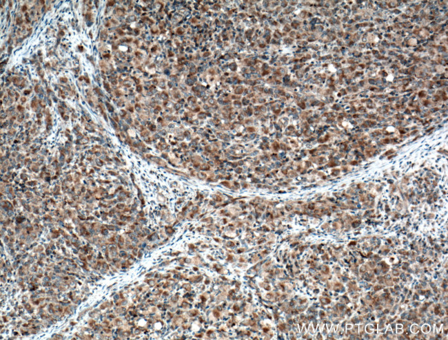 ZAP70 Antibody in Immunohistochemistry (Paraffin) (IHC (P))