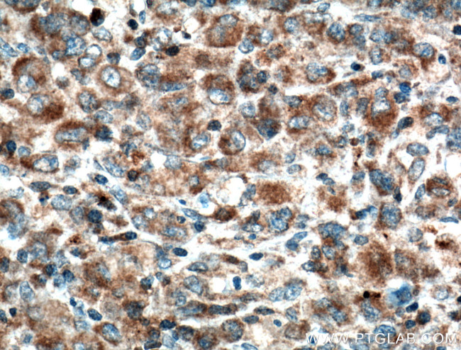 ZAP70 Antibody in Immunohistochemistry (Paraffin) (IHC (P))