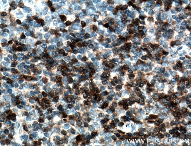 ZAP70 Antibody in Immunohistochemistry (Paraffin) (IHC (P))