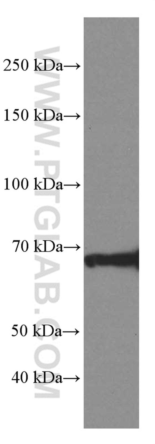 ZAP70 Antibody in Western Blot (WB)