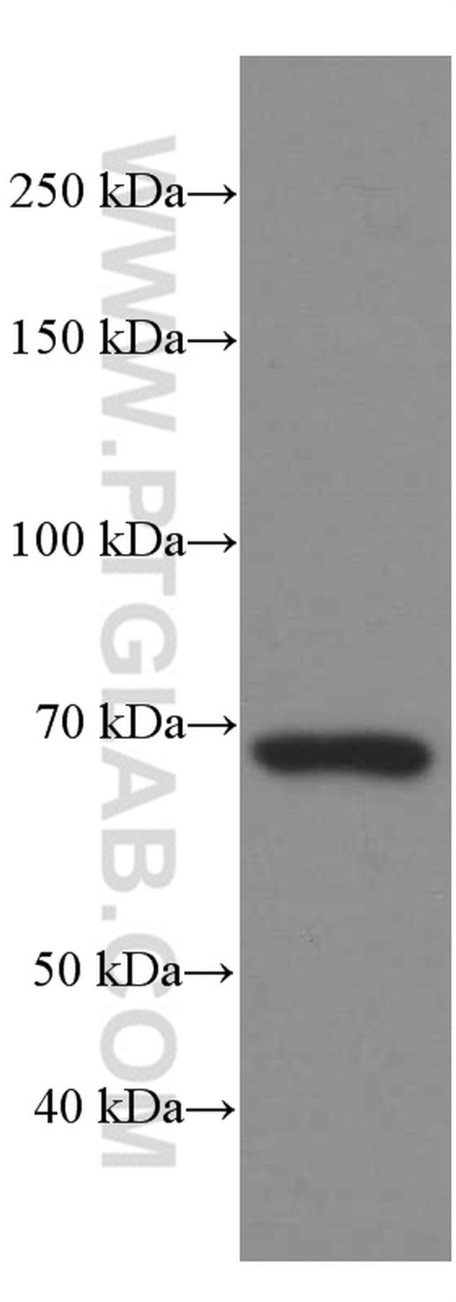 ZAP70 Antibody in Western Blot (WB)