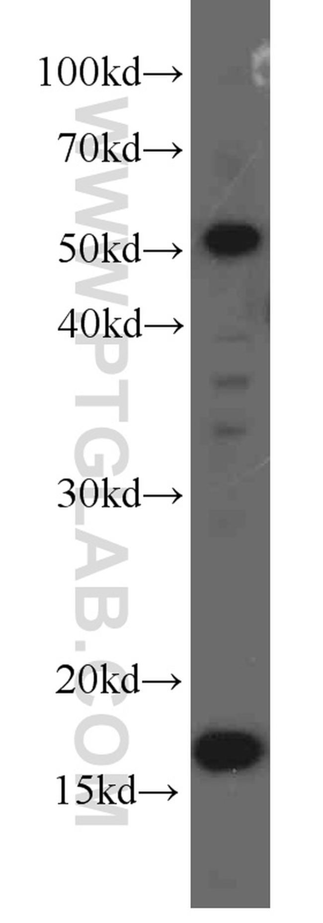 UBC9 Antibody in Western Blot (WB)