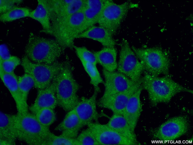 peroxiredoxin 2 Antibody in Immunocytochemistry (ICC/IF)