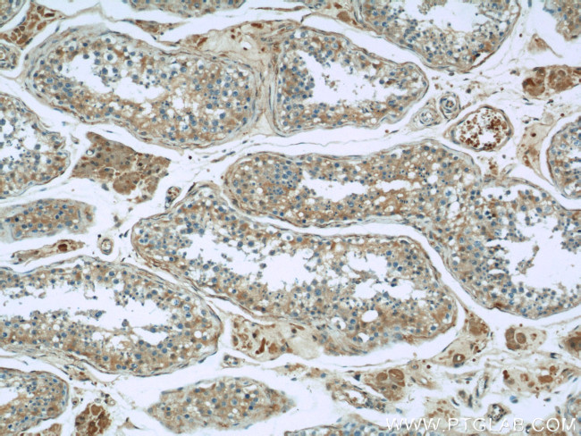 peroxiredoxin 2 Antibody in Immunohistochemistry (Paraffin) (IHC (P))