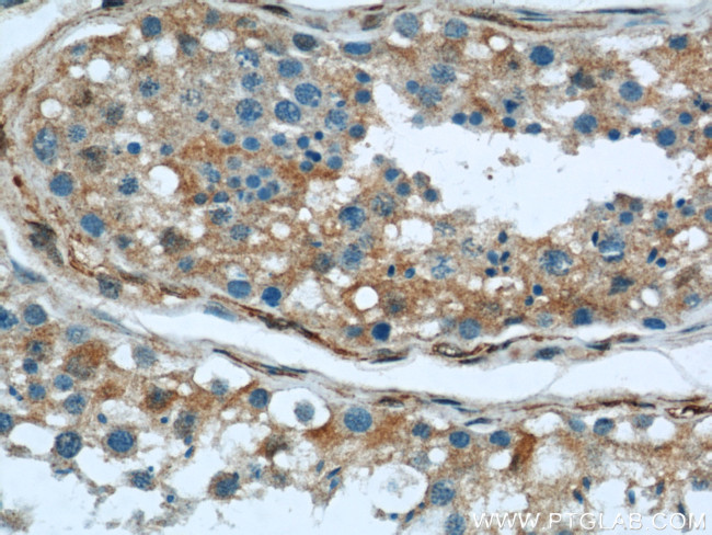 peroxiredoxin 2 Antibody in Immunohistochemistry (Paraffin) (IHC (P))