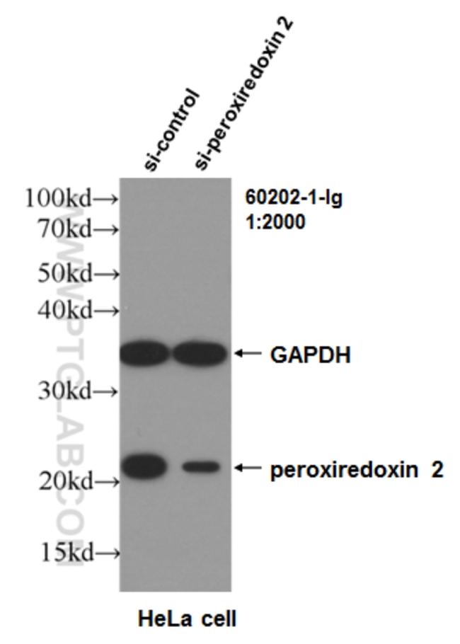 peroxiredoxin 2 Antibody in Western Blot (WB)