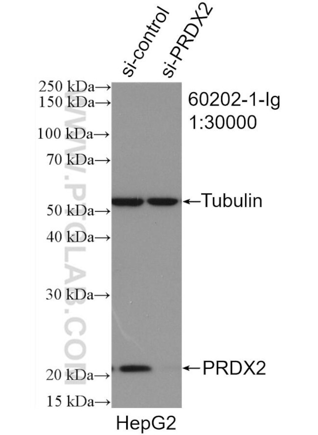 peroxiredoxin 2 Antibody in Western Blot (WB)