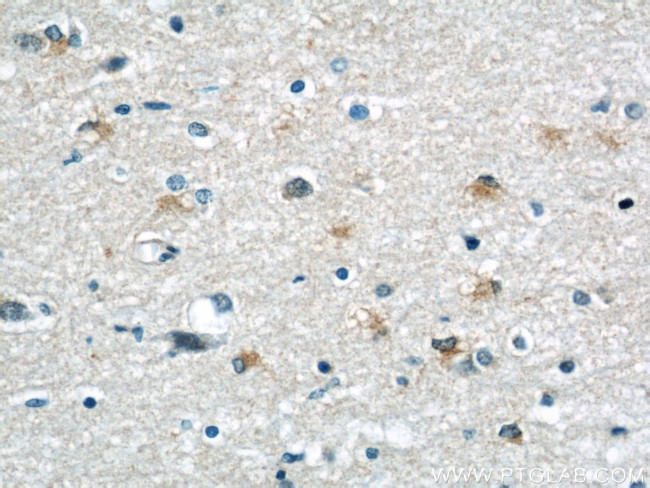 peroxiredoxin 2 Antibody in Immunohistochemistry (Paraffin) (IHC (P))