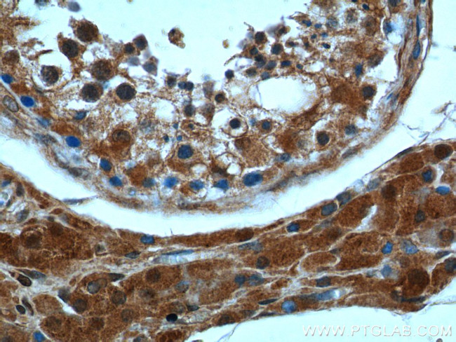 peroxiredoxin 2 Antibody in Immunohistochemistry (Paraffin) (IHC (P))