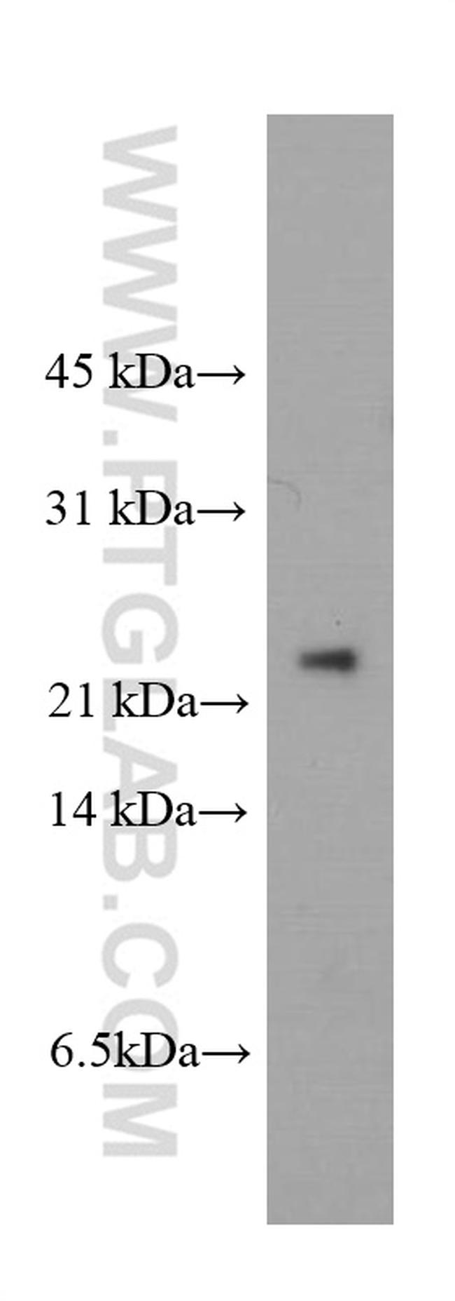 peroxiredoxin 2 Antibody in Western Blot (WB)