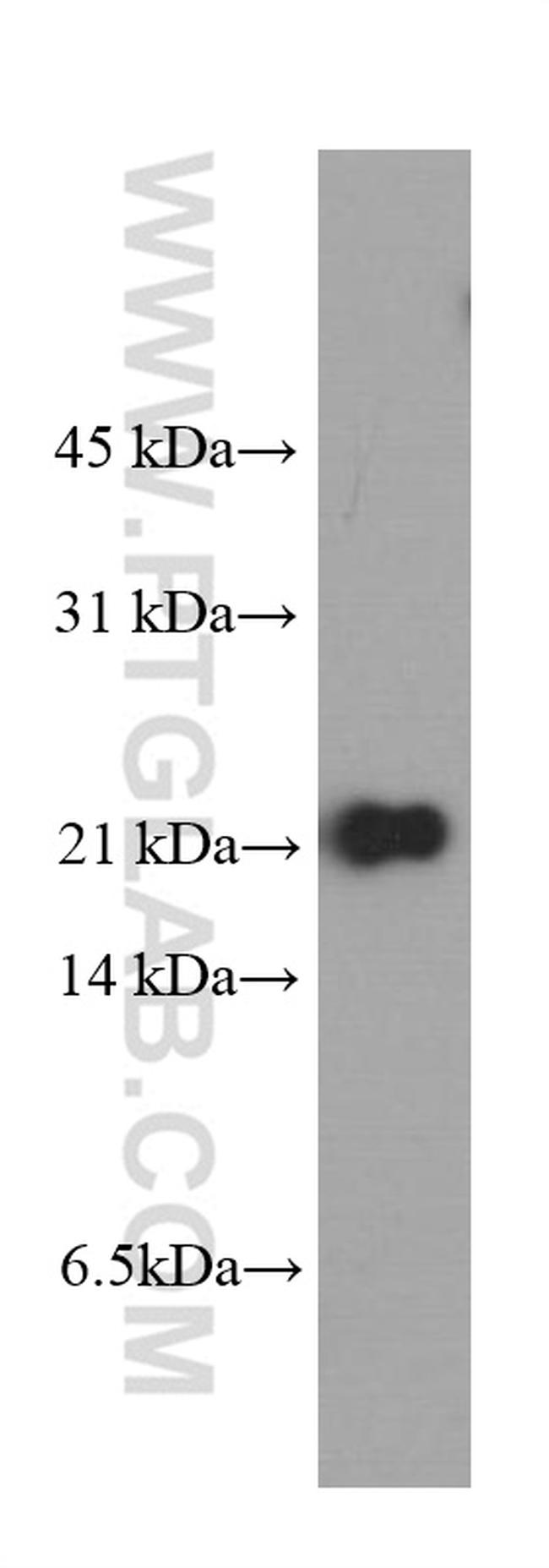 peroxiredoxin 2 Antibody in Western Blot (WB)