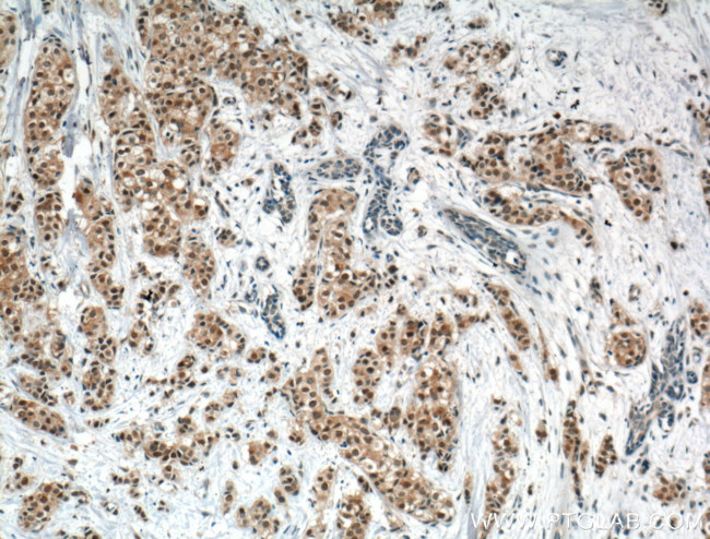 AKT Antibody in Immunohistochemistry (Paraffin) (IHC (P))