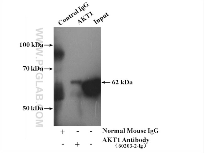AKT Antibody in Immunoprecipitation (IP)