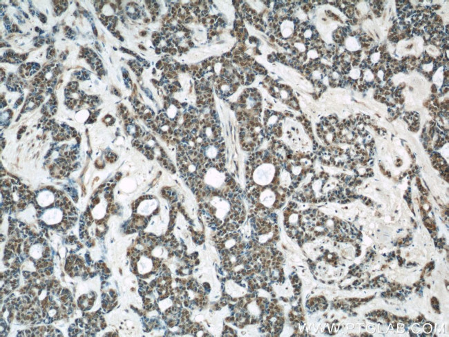 AKT Antibody in Immunohistochemistry (Paraffin) (IHC (P))