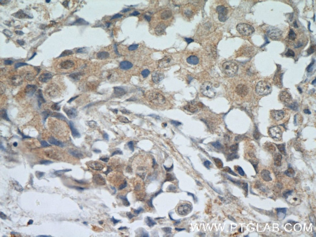 AKT Antibody in Immunohistochemistry (Paraffin) (IHC (P))