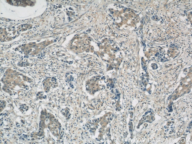 AKT Antibody in Immunohistochemistry (Paraffin) (IHC (P))