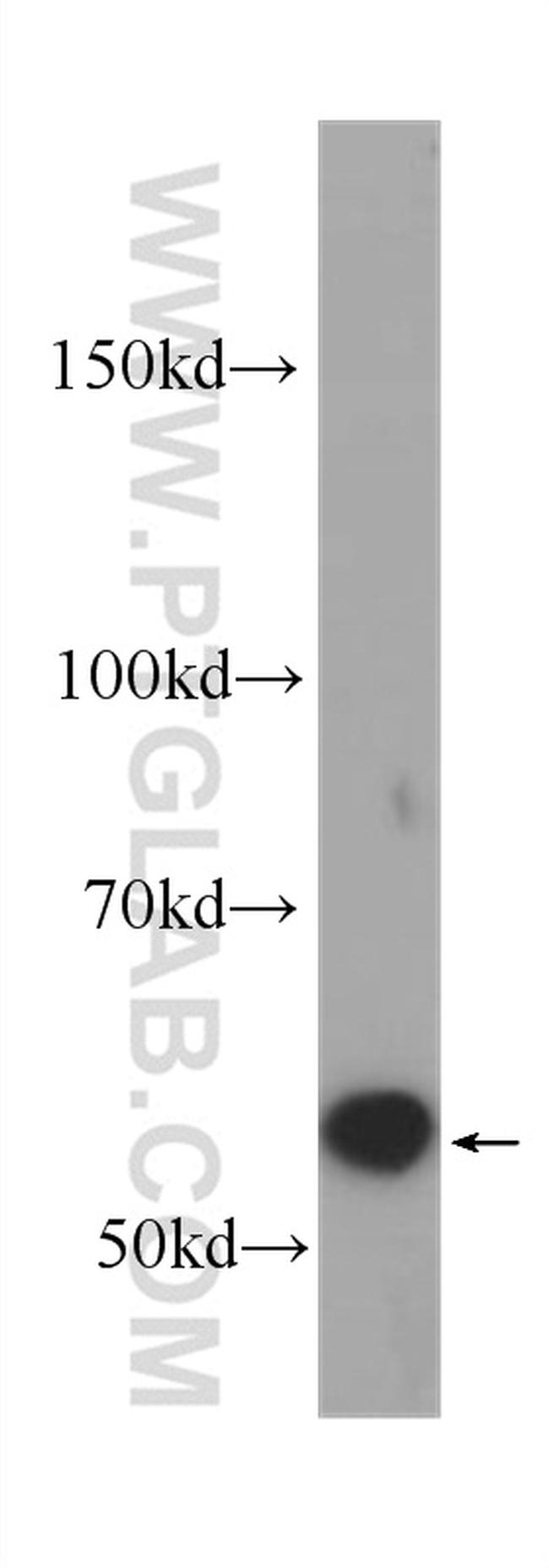 AKT Antibody in Western Blot (WB)