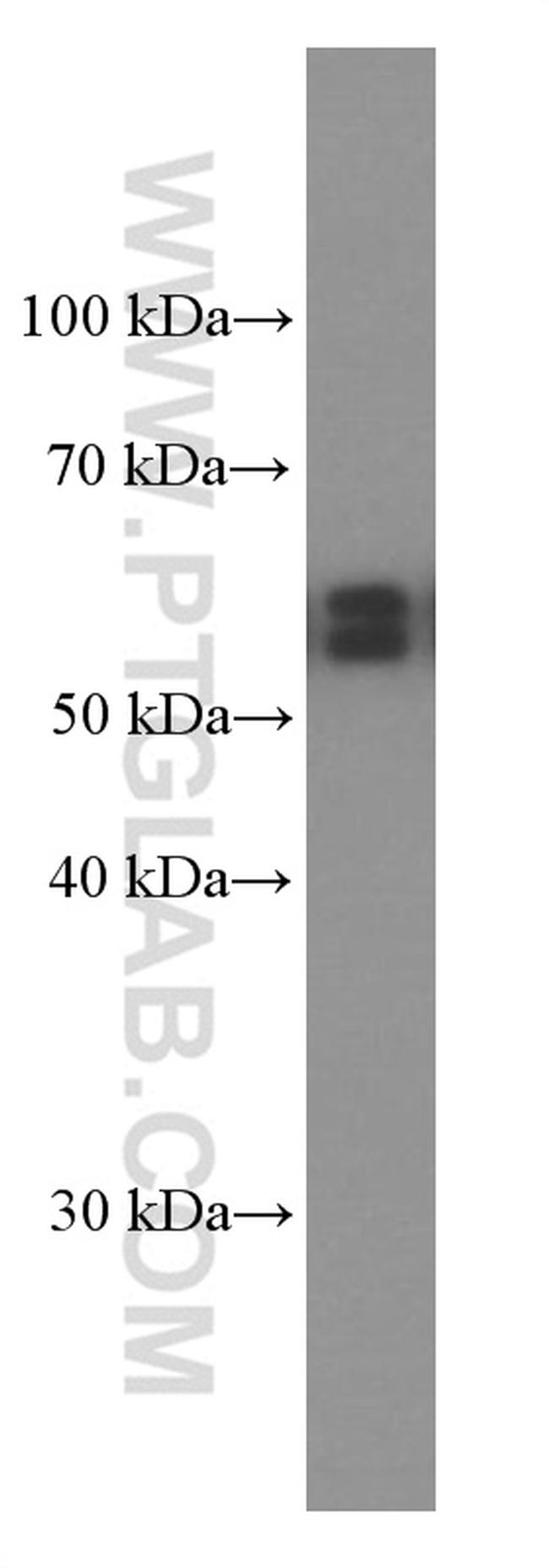 AKT Antibody in Western Blot (WB)