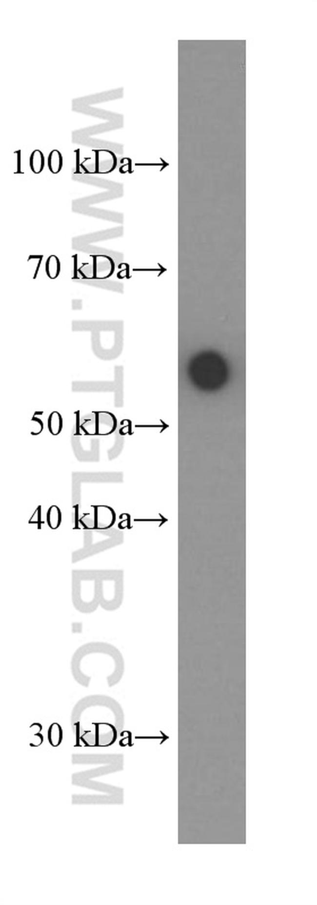 AKT Antibody in Western Blot (WB)