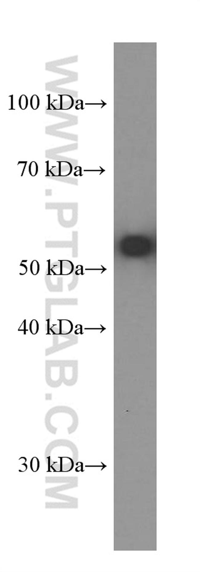 AKT Antibody in Western Blot (WB)