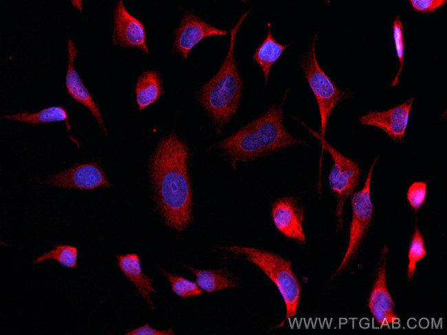 Galectin-3 Antibody in Immunocytochemistry (ICC/IF)