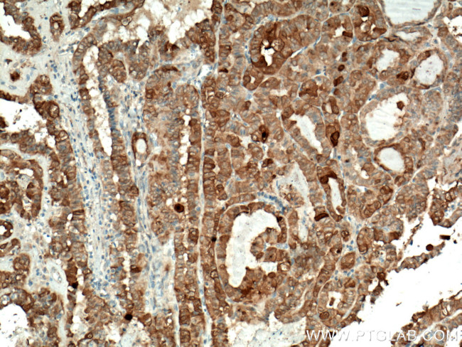 Galectin-3 Antibody in Immunohistochemistry (Paraffin) (IHC (P))