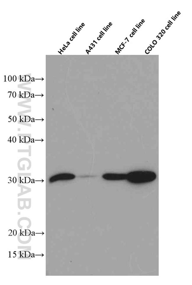 Galectin-3 Antibody in Western Blot (WB)