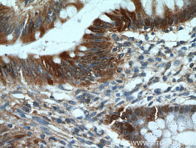 Galectin-3 Antibody in Immunohistochemistry (Paraffin) (IHC (P))