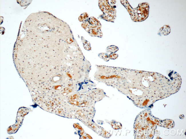 LYN Antibody in Immunohistochemistry (Paraffin) (IHC (P))