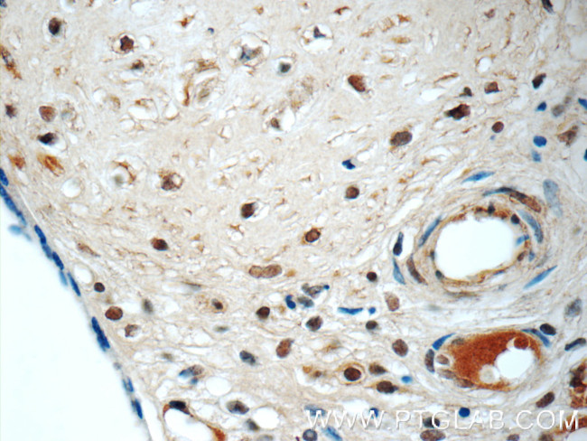 LYN Antibody in Immunohistochemistry (Paraffin) (IHC (P))