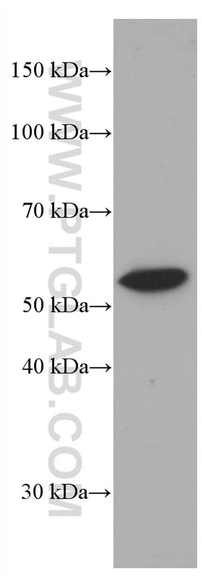 LYN Antibody in Western Blot (WB)