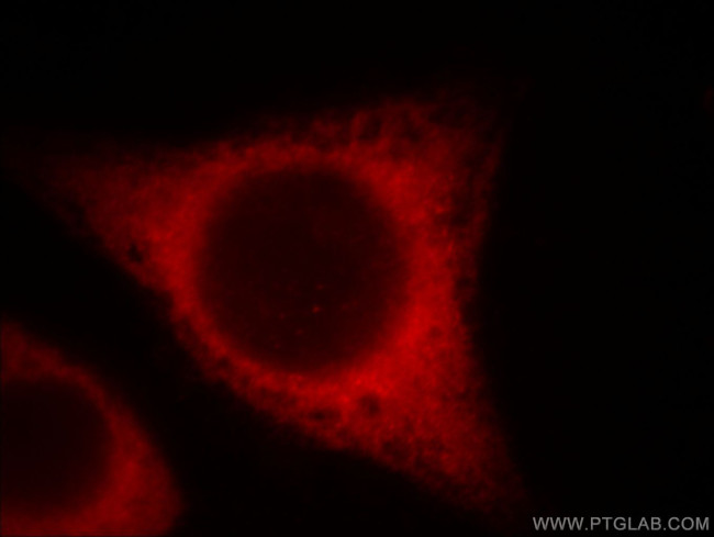 BCS1L Antibody in Immunocytochemistry (ICC/IF)