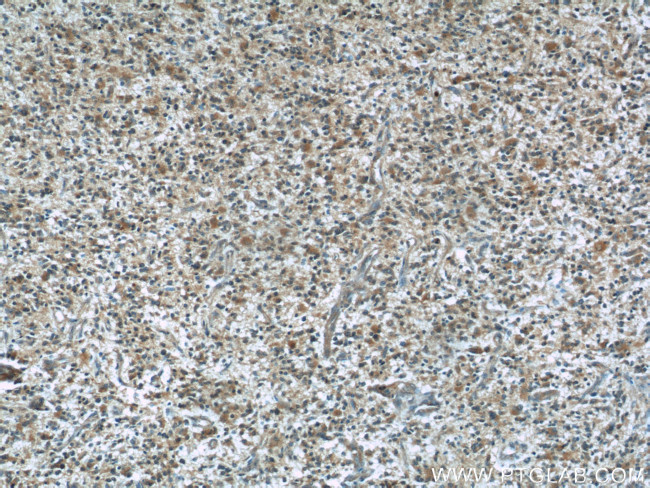 BCS1L Antibody in Immunohistochemistry (Paraffin) (IHC (P))