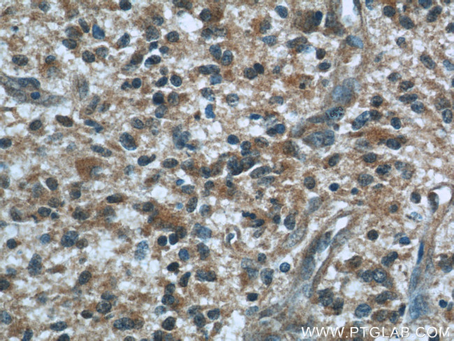 BCS1L Antibody in Immunohistochemistry (Paraffin) (IHC (P))