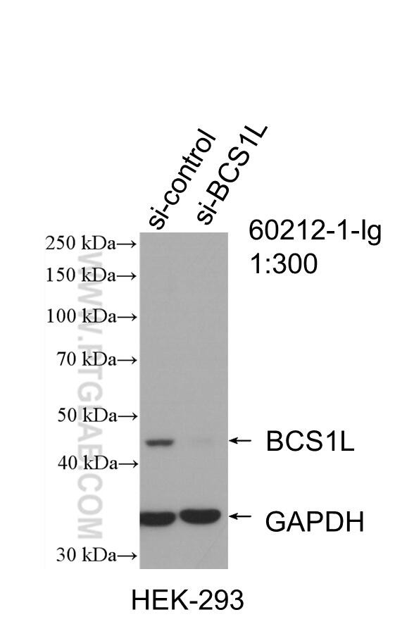 BCS1L Antibody in Western Blot (WB)