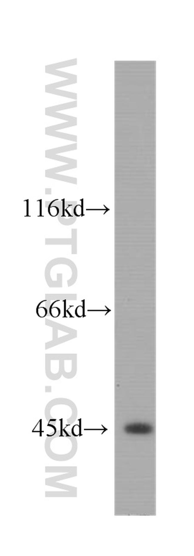 BCS1L Antibody in Western Blot (WB)