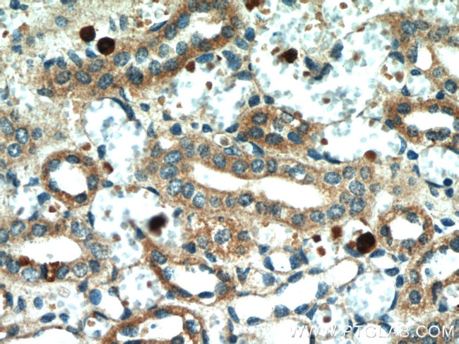 BCS1L Antibody in Immunohistochemistry (Paraffin) (IHC (P))