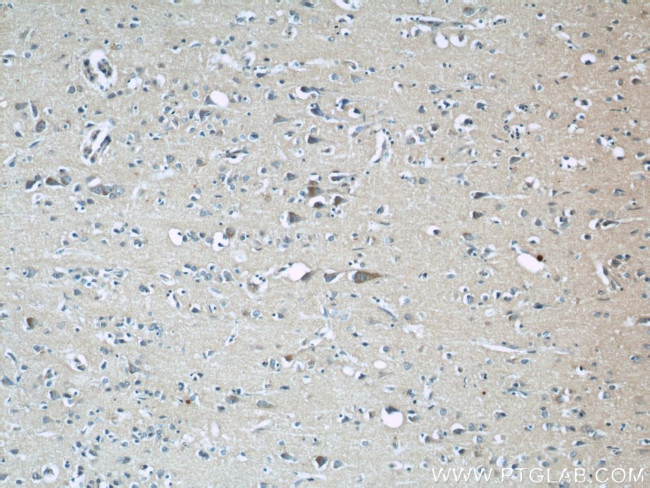 BCS1L Antibody in Immunohistochemistry (Paraffin) (IHC (P))