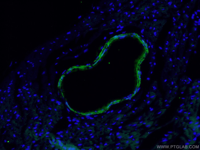 transgelin/SM22 Antibody in Immunohistochemistry (PFA fixed) (IHC (PFA))