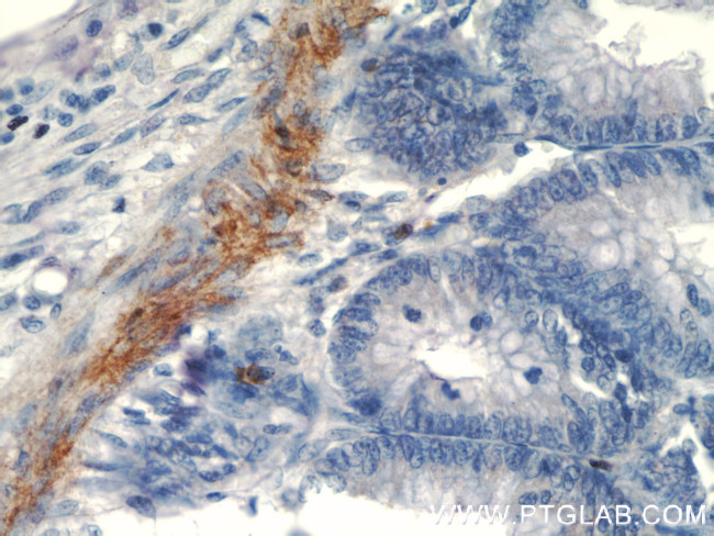 transgelin/SM22 Antibody in Immunohistochemistry (Paraffin) (IHC (P))