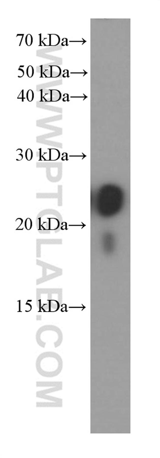 transgelin/SM22 Antibody in Western Blot (WB)