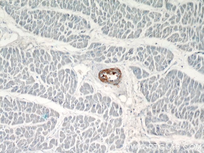 transgelin/SM22 Antibody in Immunohistochemistry (Paraffin) (IHC (P))