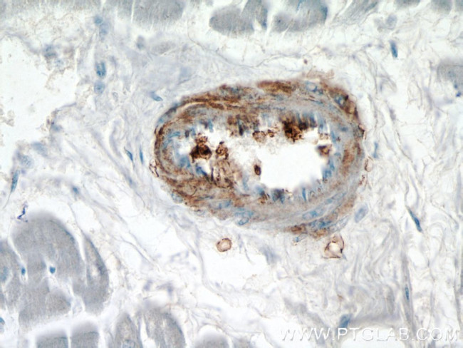 transgelin/SM22 Antibody in Immunohistochemistry (Paraffin) (IHC (P))