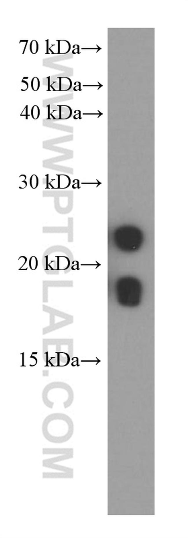 transgelin/SM22 Antibody in Western Blot (WB)