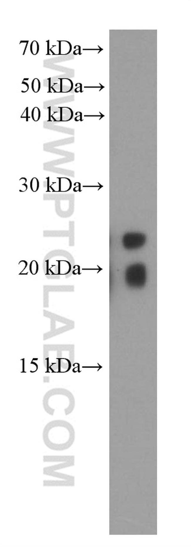 transgelin/SM22 Antibody in Western Blot (WB)