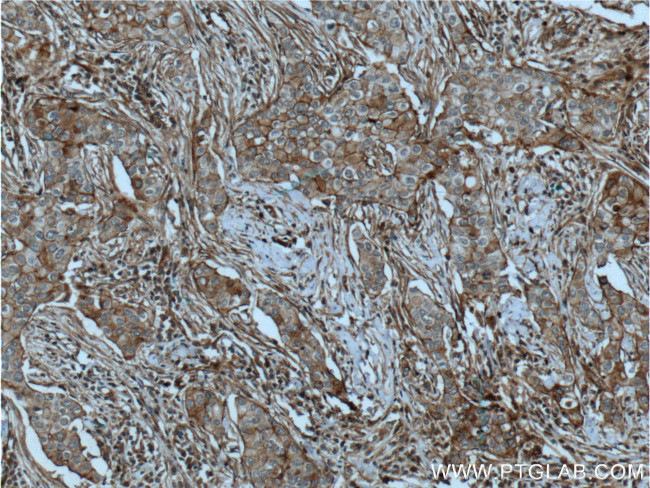 CXCR7 Antibody in Immunohistochemistry (Paraffin) (IHC (P))