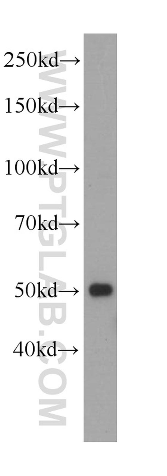 PAX1 Antibody in Western Blot (WB)