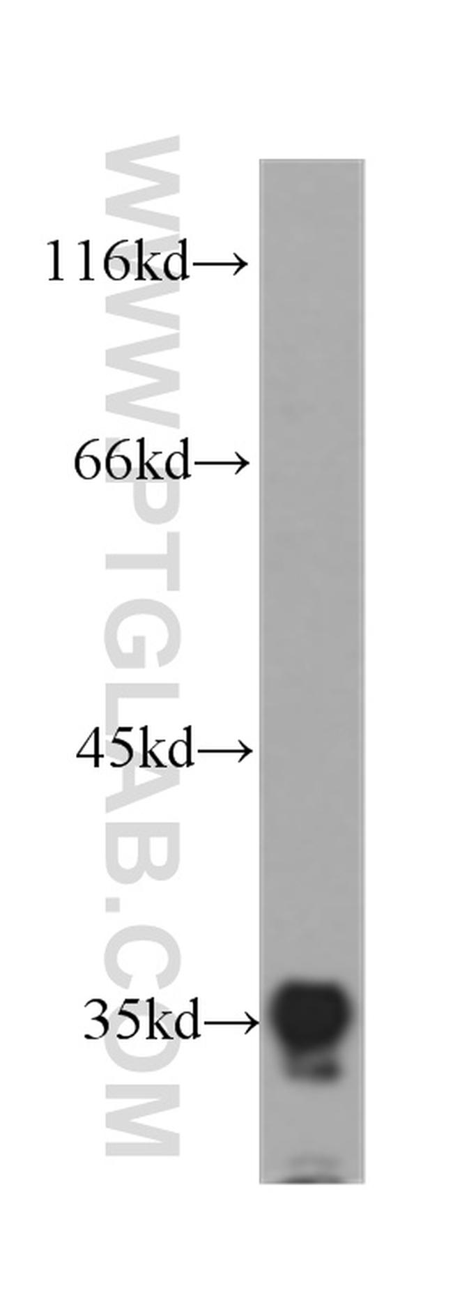 IL20RB Antibody in Western Blot (WB)