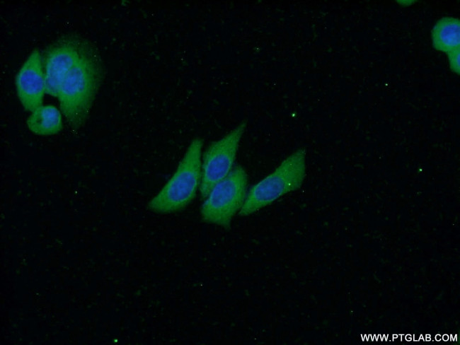 SMMHC Antibody in Immunocytochemistry (ICC/IF)