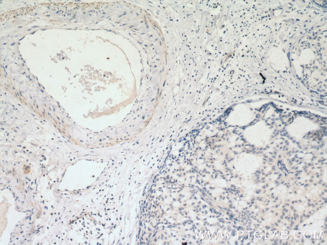 SMMHC Antibody in Immunohistochemistry (Paraffin) (IHC (P))